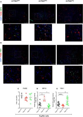 Tribbles-1 Expression and Its Function to Control Inflammatory Cytokines, Including Interleukin-8 Levels are Regulated by miRNAs in Macrophages and Prostate Cancer Cells